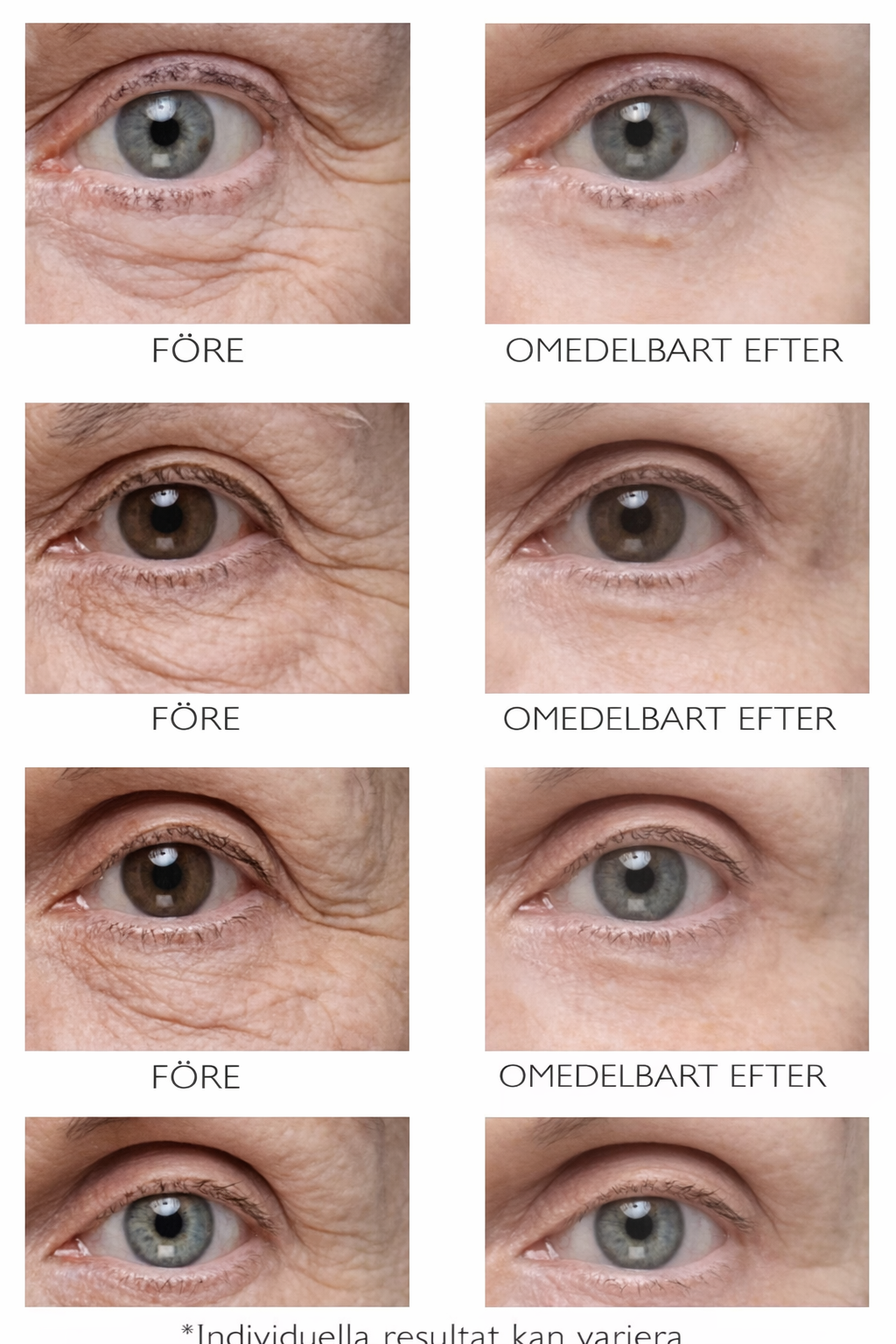 Peter Thomas Roth Instant FIRMx® Eye™ — Immediate Tightening & Visibly Smoother Eye Area