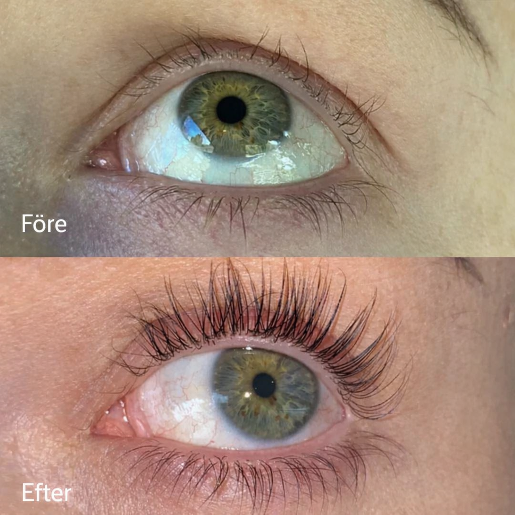 FORCHICS™ Double Eyelash Serum for Reconstruction — Strength, Length, Beauty. - Buy 1 Get 1 FREE