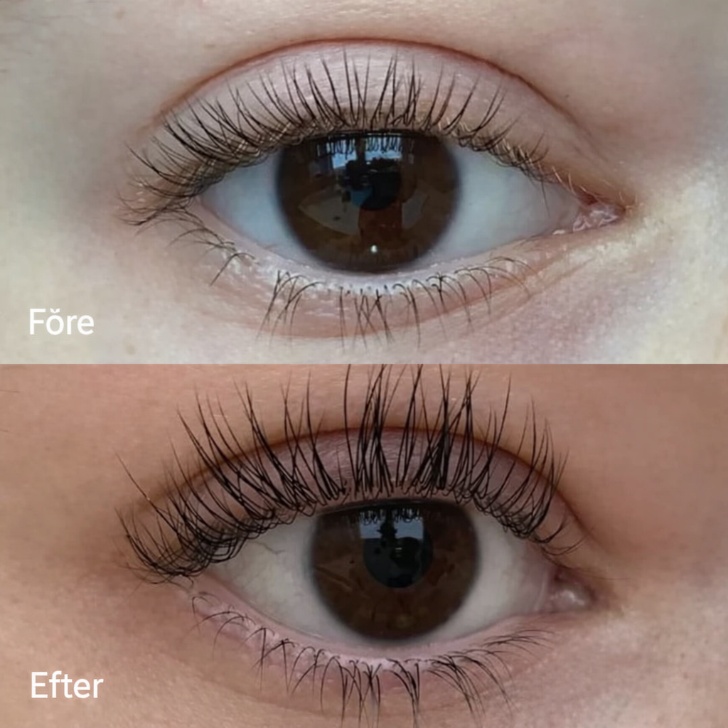 FORCHICS™ Double Eyelash Serum for Reconstruction — Strength, Length, Beauty. - Buy 1 Get 1 FREE