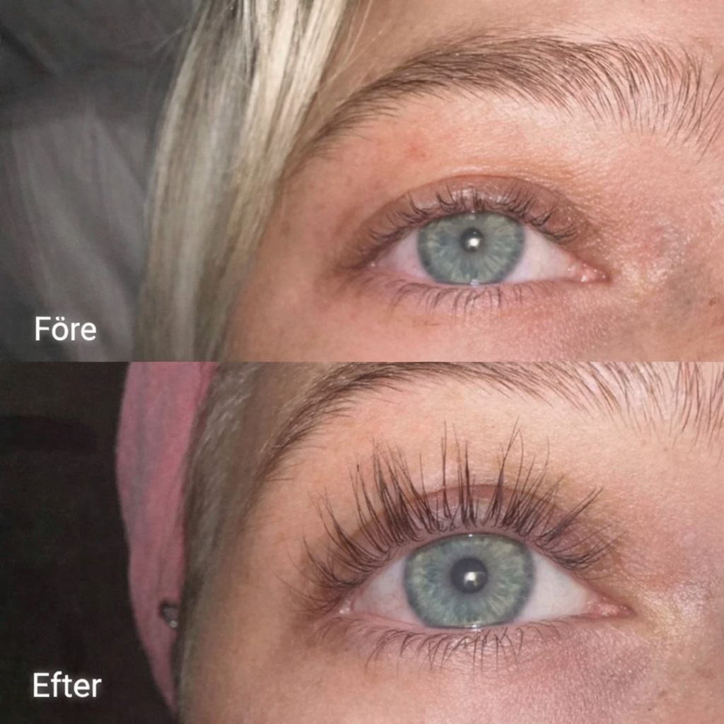 FORCHICS™ Double Eyelash Serum for Reconstruction — Strength, Length, Beauty. - Buy 1 Get 1 FREE