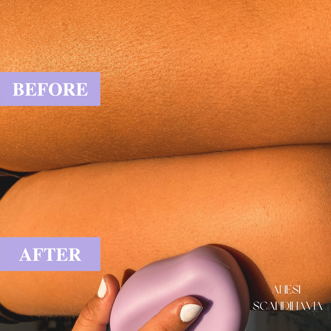 HÈSTIA™ Painless Hair Remover